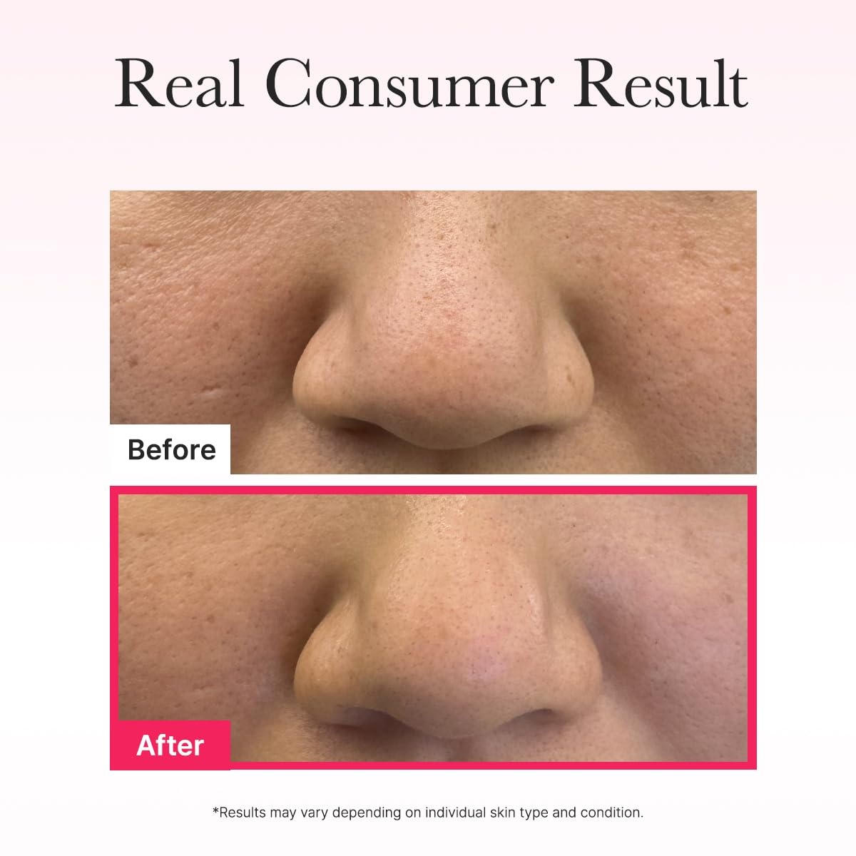 image:imageARENCIA Vita Collagen Radiance Jello Mask Hydrogel Face Mask with Collagen amp Glutathione Cooling amp Hydrating Care for SmoothLooking Skin 4 SheetsCollagen