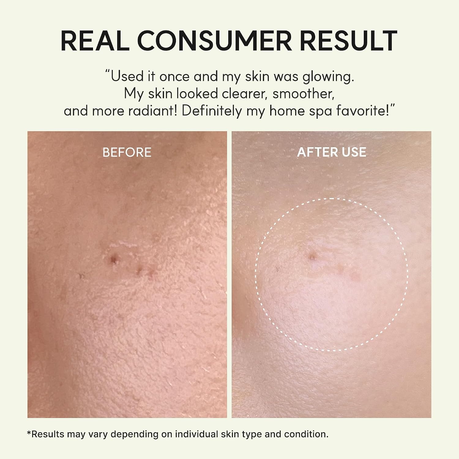 image:imageARENCIA Vita Collagen Radiance Jello Mask Hydrogel Face Mask with Collagen amp Glutathione Cooling amp Hydrating Care for SmoothLooking Skin 4 SheetsVitamin C