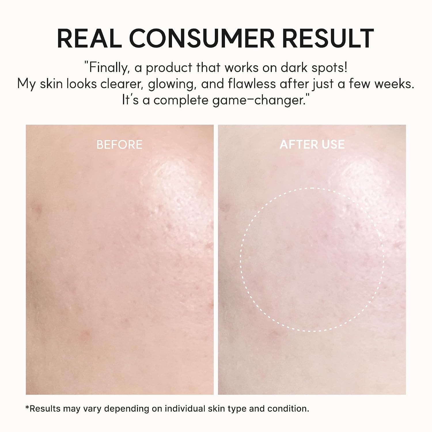 image:imageARENCIA Vitamin C Booster Gel Cream with Niacinamide amp Glutathione amp Ceramide Hydrating Gel Moisturizer Supports EvenLooking Skin Tone amp Smooth Texture 50 g 176 oz