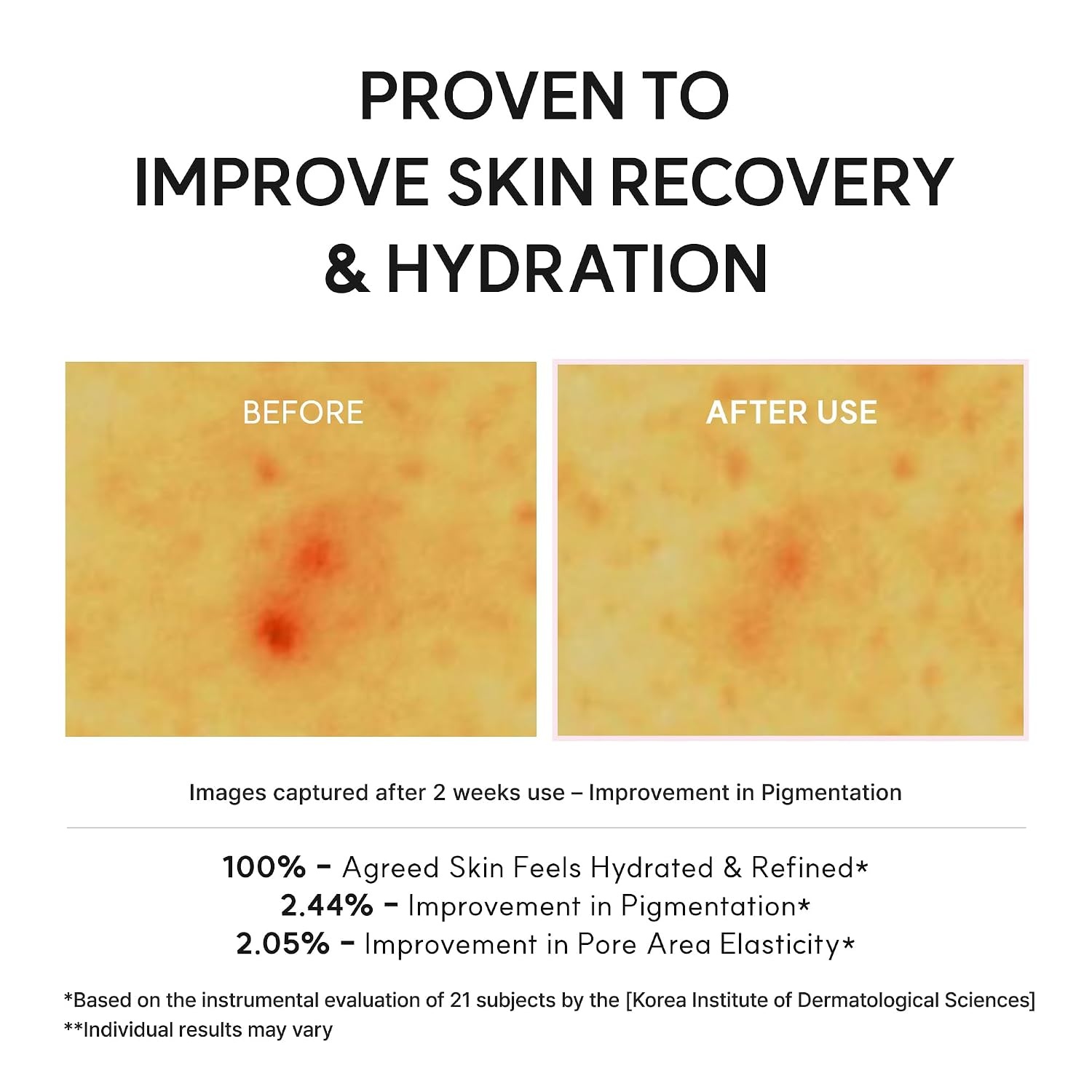 image:imageArencia Vitamin C Booster Shot Serum with Glutathione Niacinamide and Vitamin E for Dark Spot Care Fine Lines amp Wrinkles Glass Skin Korean Skincare 30ml101 flozPDRN