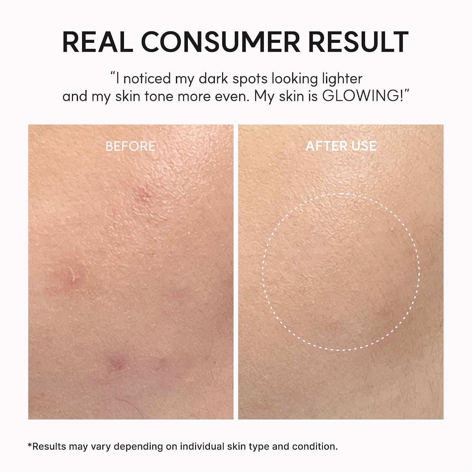 image:imageArencia Vitamin C Booster Shot Serum with Glutathione Niacinamide and Vitamin E for Dark Spot Care Fine Lines amp Wrinkles Glass Skin Korean Skincare 30ml101 flozTXA