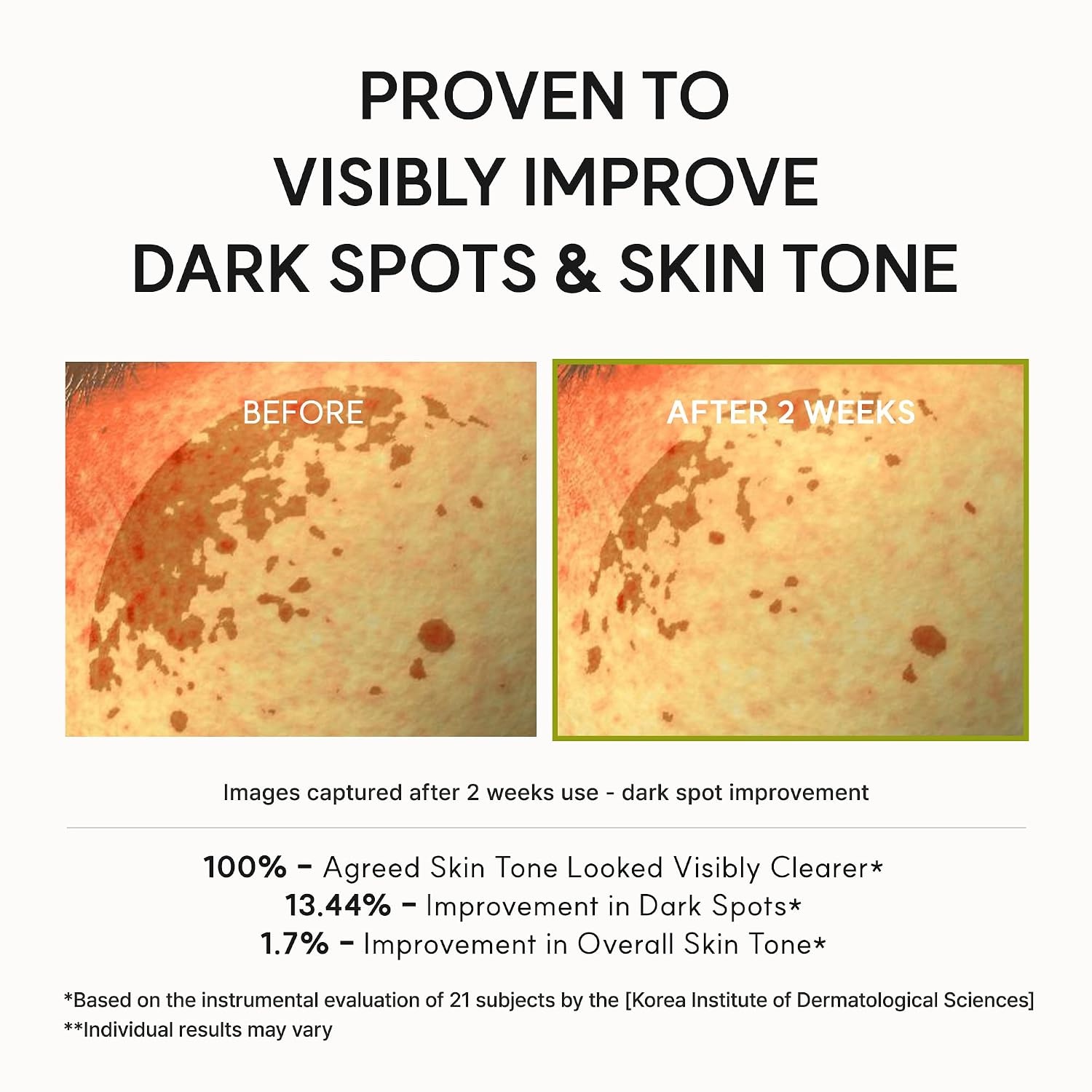 image:imageArencia Vitamin C Booster Shot Serum with Glutathione Niacinamide and Vitamin E for Dark Spot Care Fine Lines amp Wrinkles Glass Skin Korean Skincare 30ml101 flozVitamin C