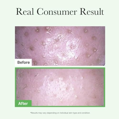image:imageARENCIA Pore Melt Mochi MakeupRemoving Cleansing Oil NonComedogenic Rice Amino Acids HD Vitamin E Cica amp Ceramide 676 fl oz676 Fl Oz Pack of 2