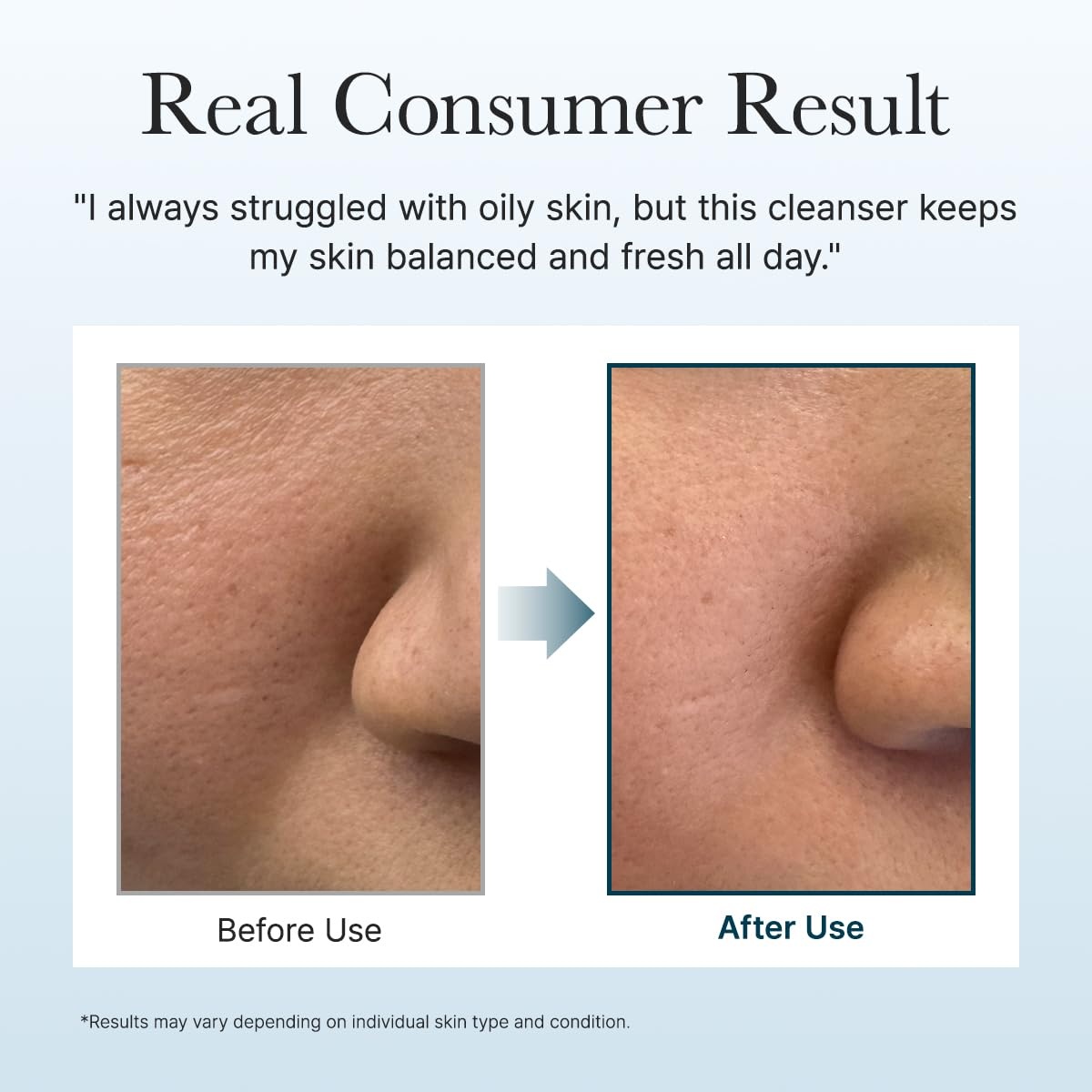 image:imageArencia Black Tea Rice Mochi Face Cleanser DeepCleansing Pore Care Sebum Control Oily Skin 120g 423 ozBlue Hyssop